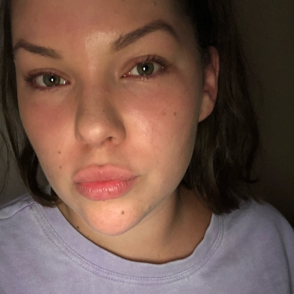 Aloha!! - Picture 1 of 1